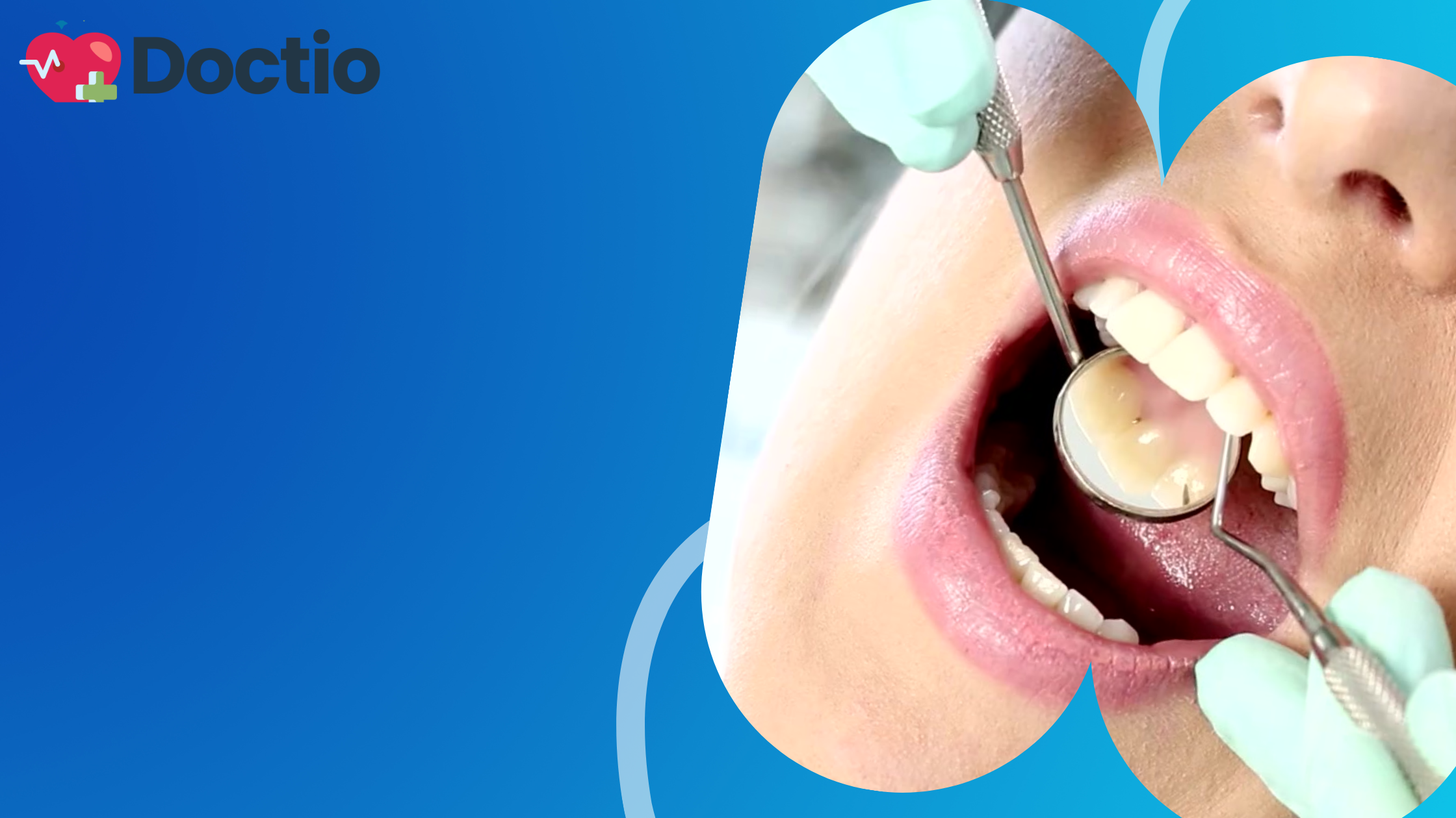 dentist in Dubai
